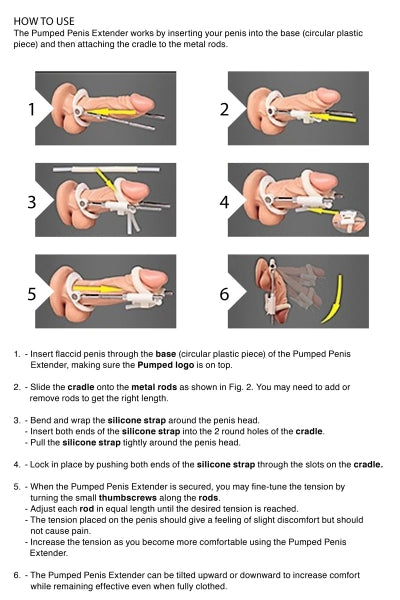 Extensor de pene